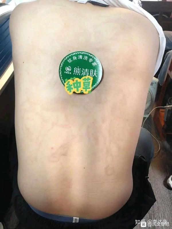 洗纹身最快的方法,一次能不能洗干净