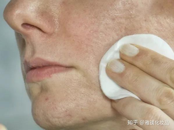 错误卸妆粗糙暗沉黑头找上门