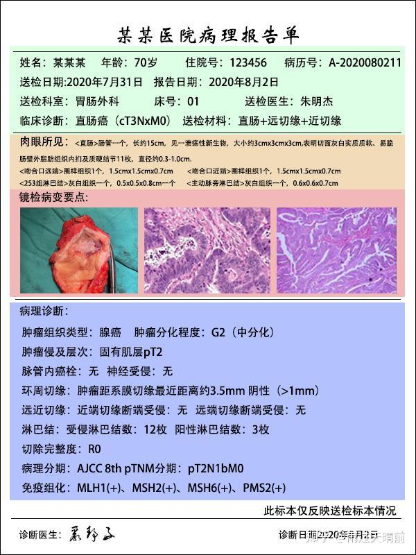 最简单方法读懂结直肠癌病理报告单