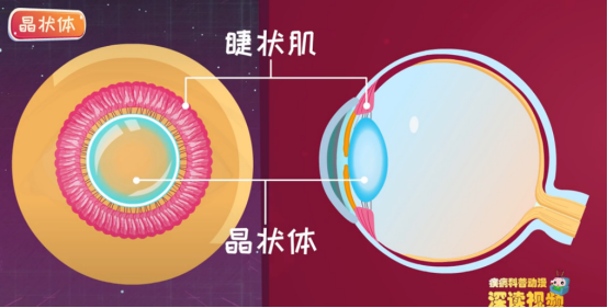 如果睫状肌一直收缩,根本放松不下来,晶状体就一直调整不到扁平状态