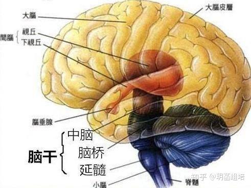 脑干出血部位,多发于脑桥