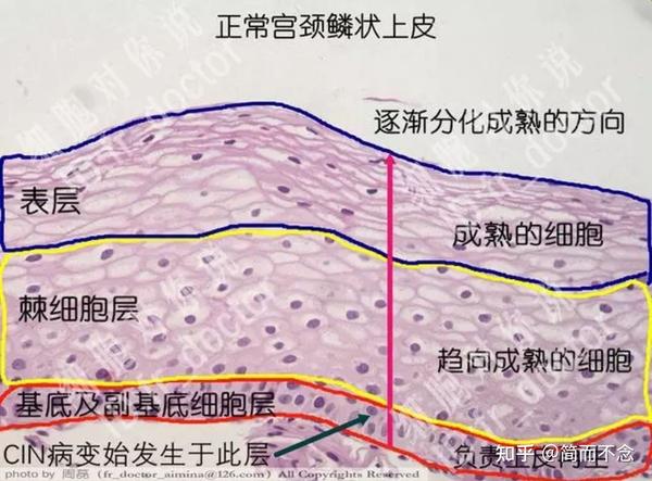 宫颈hpv阳性癌前病变选择冷刀治疗或leep的利弊