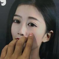 瘦脸-知乎了针可以吗做柳絮去脸美容院打图片