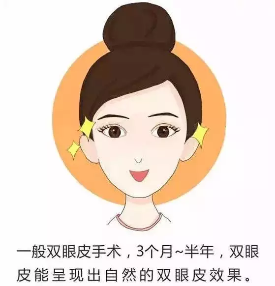 做完双眼皮后该怎么护理才恢复快?