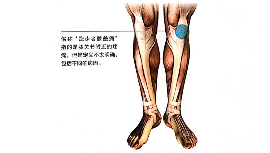 跑步爱好者患有的膝关节疼痛包括不同类型,如果是膝盖骨上方疼痛的话