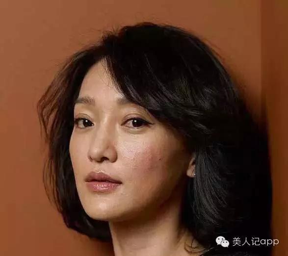 治疗痘痘最有用的方法是什么