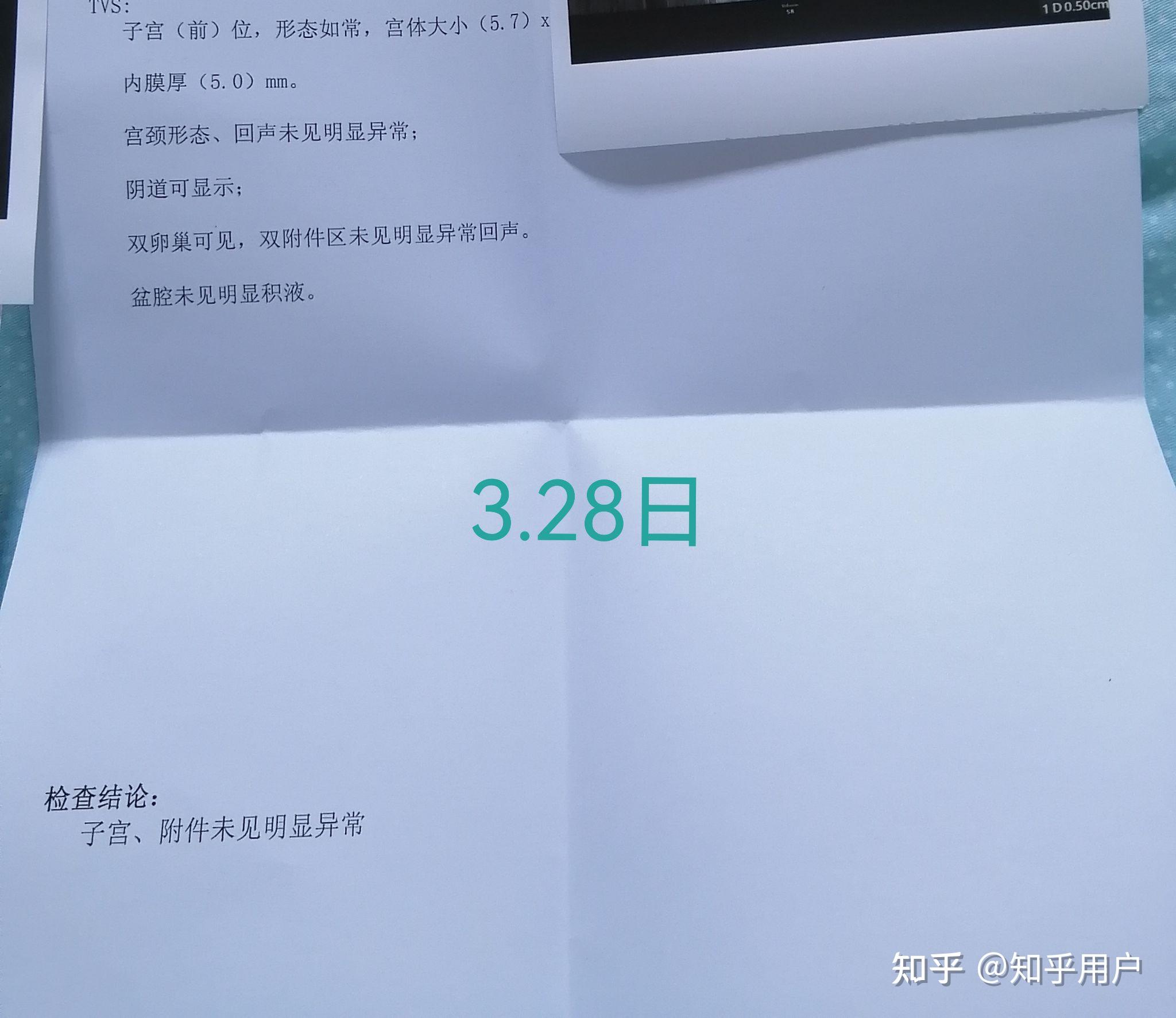 21 条评论默认时间代表月亮消灭你16天复查,4厘米残留,hcg273,医生让