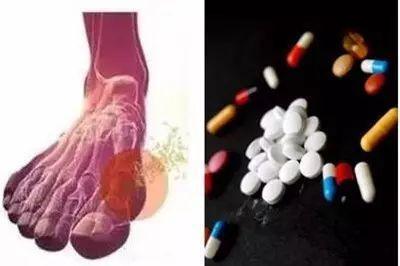 痛风科普:停用非布以后,是它导致了尿酸的报复性升高?