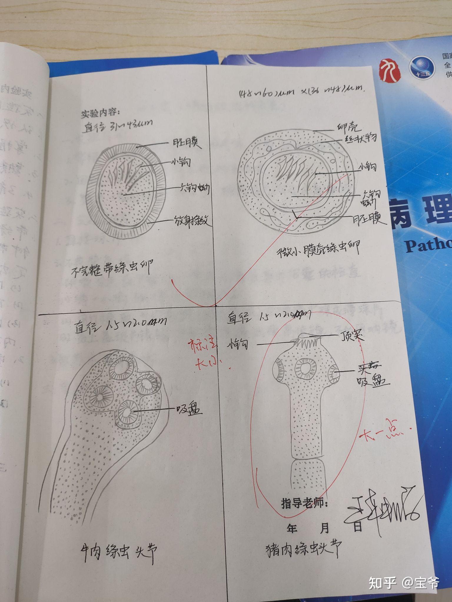 寄生虫手绘图 知乎