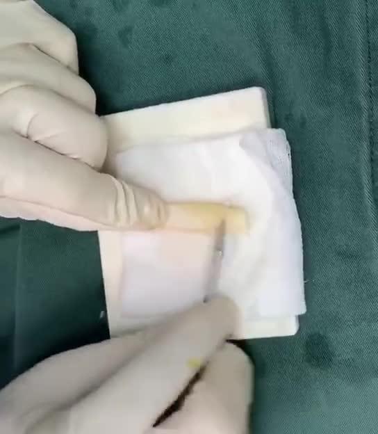 肋软骨雕刻,你不知道的秘密.
