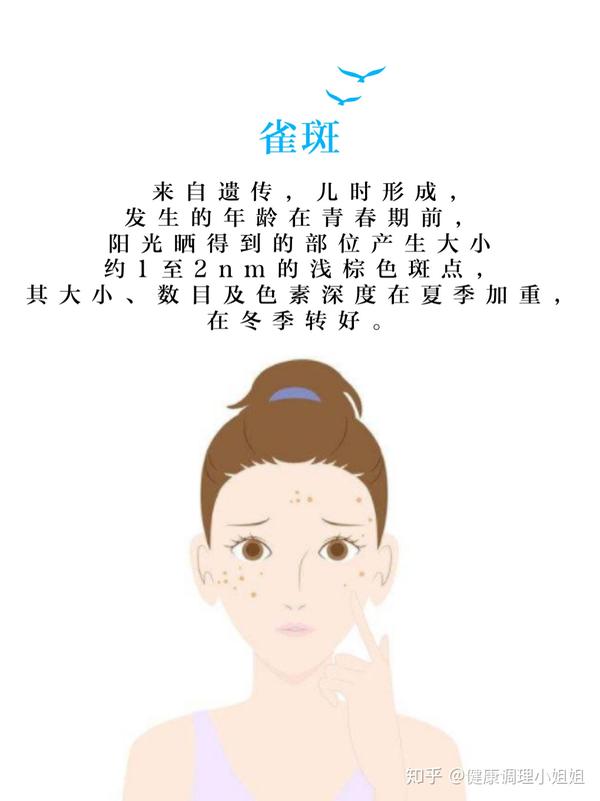 先辨别再祛斑,有效更靠谱!