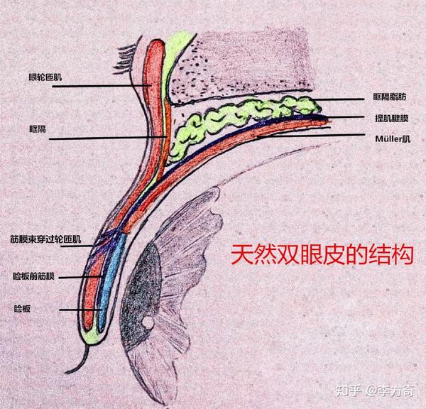 结构的前提下,能祛除多余的皮肤,并在直视下避开循环网缝合双眼皮把皮