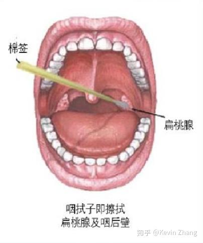 原创疫情与数据采集不准确则分析无意义