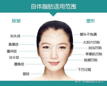 面部填充哪个部位最好看?