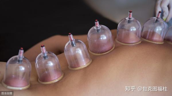 比如:哮喘,带状疱疹,颈肩腰腿痛,感冒等,以及现在比较流行的拔罐能