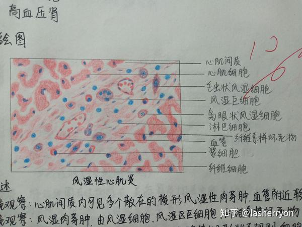 1.肝细胞脂肪变性 2.肉芽组织 3.慢性肺淤血 4.混合血栓 5.