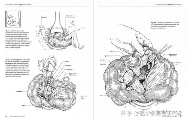 2018年美国医学插画协会ami沙龙展巡礼三十六