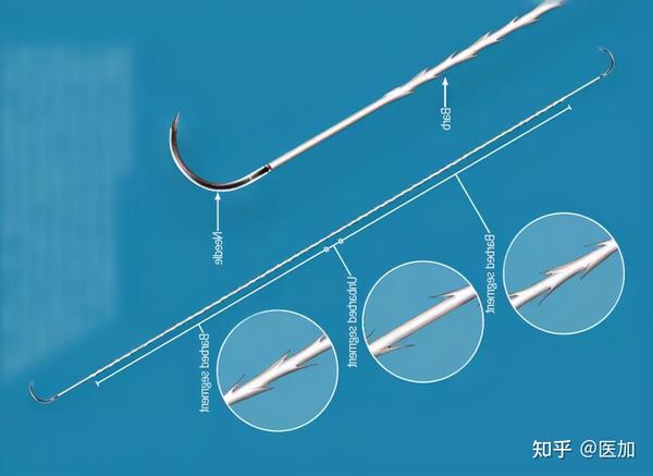 高性价比柯惠倒刺线