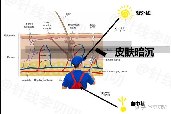 自由基让皮肤发黑的的原理