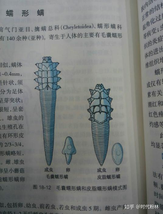 螨虫即毛囊虫,其中毛囊蠕和皮脂蠕都会形成螨虫,在毛囊皮脂腺内寄生