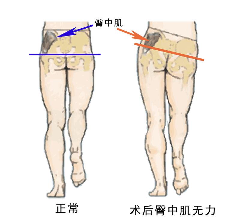 你有长短腿吗援藏第42天