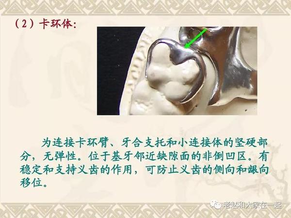 决胜2020医考│五星难度,口腔修复,卡环设计题