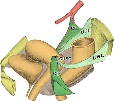 主韧带 cardinal ligament(cl)和 宫骶韧带 uterosacral ligament(usl