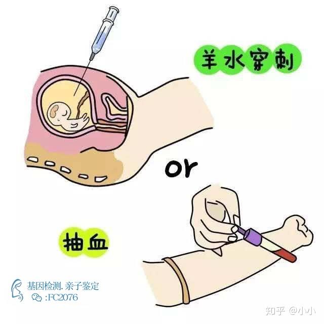 高龄产妇做香港产前胎儿无创dna检测安全吗?