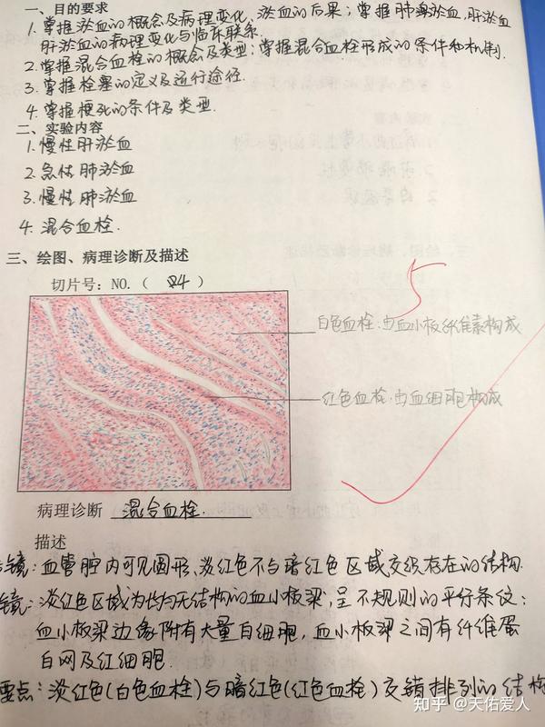 病理学实验报告