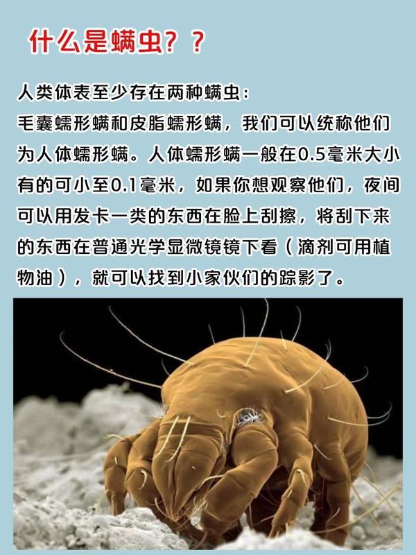如何判断身上是否有螨虫