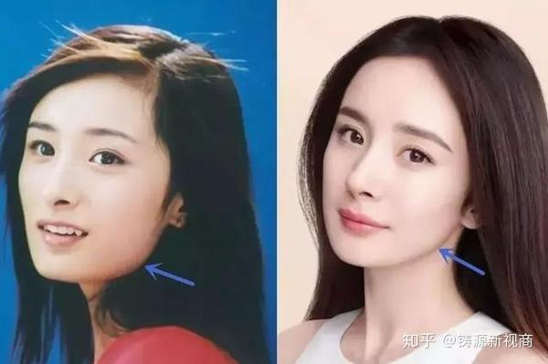 比发福更可怕,刘亦菲也没能幸免,因"发腮"上热搜,如何