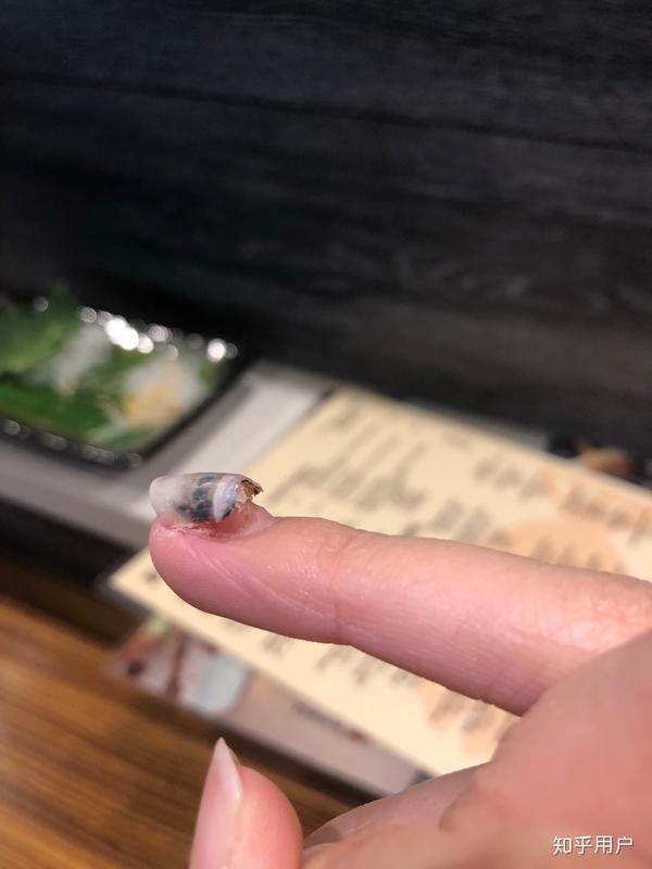手指被门夹到飙泪是种怎样的体验?