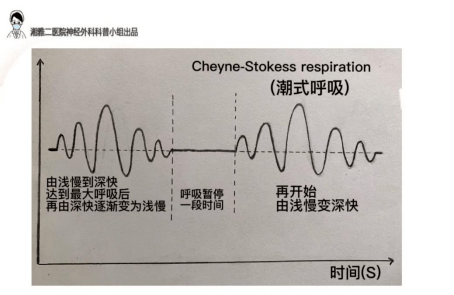 Cheyne Stokes 和睡眠呼吸暂停有什么联系 知乎