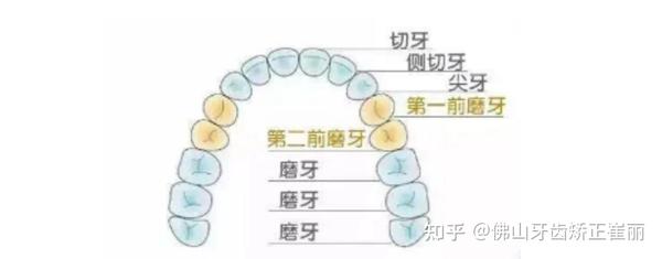 佛山牙齿矫正丨俏皮虎牙,是"可爱"还是"可怕"?