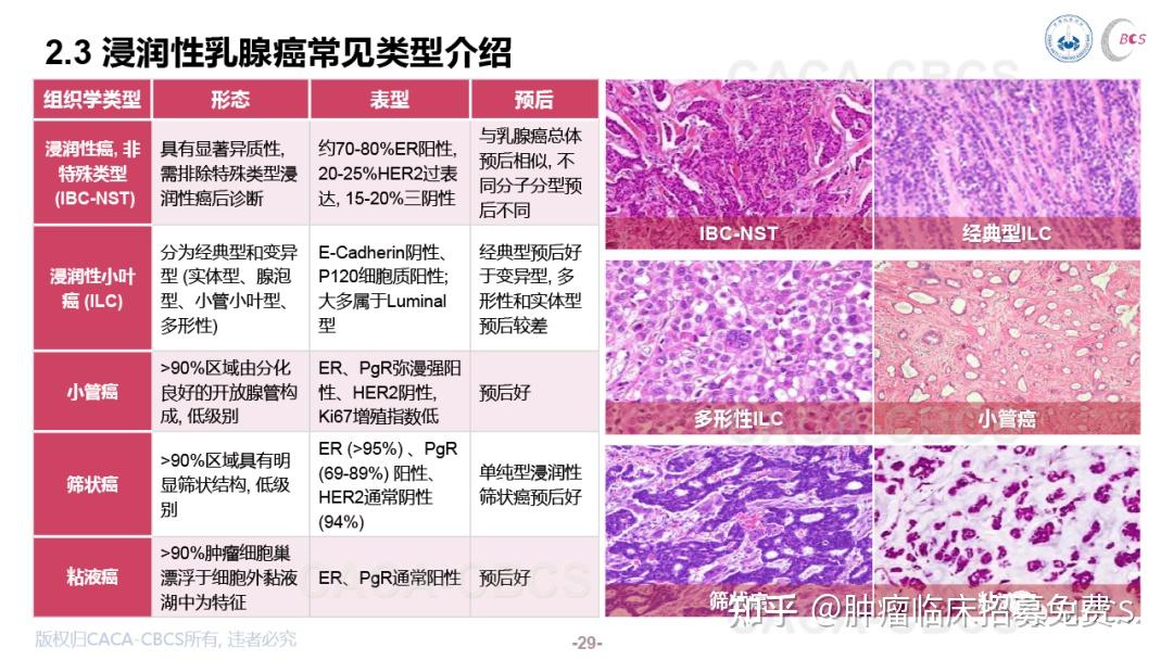 中国抗癌协会乳腺癌诊治指南与规范2021年版精要版预览 知乎