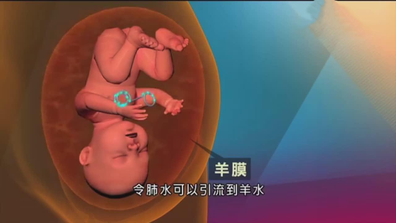 宝宝还没出生就肺部积满羊水医生用这一招救了胎儿一命