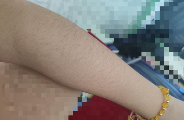女生汗毛重是怎样的一种体验?