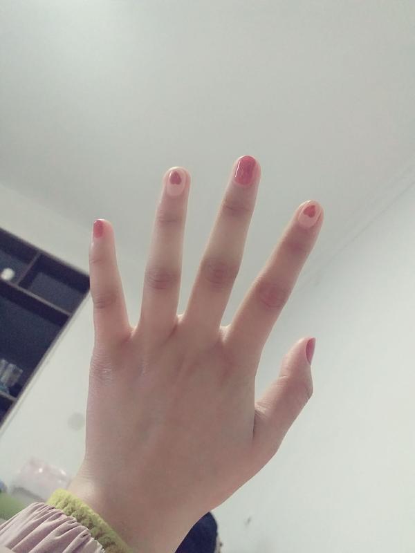 女生手指关节发黑何解决?
