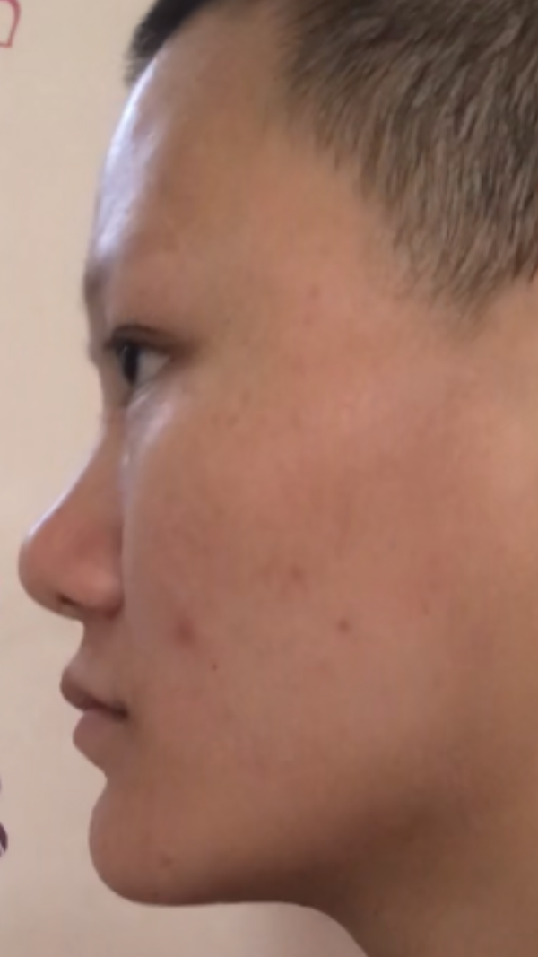 可人跟人是不一样的,高鼻梁加分啊!