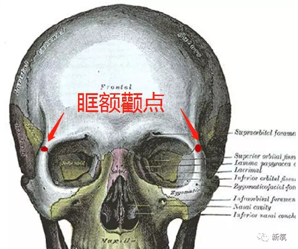 先回顾一个部位,眶额颧点,下图那两个红点的地方,恰好在几块骨头交合