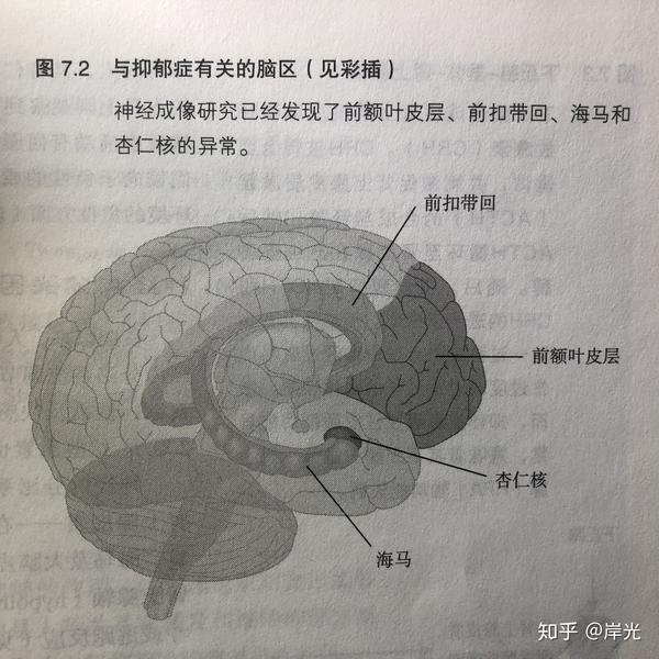 关于抑郁症的33条基本常识