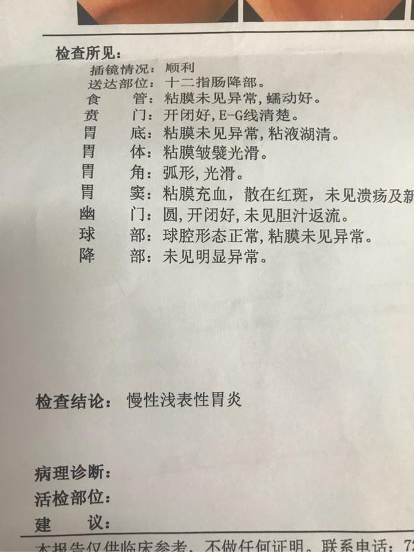 做胃镜是种怎样的体验