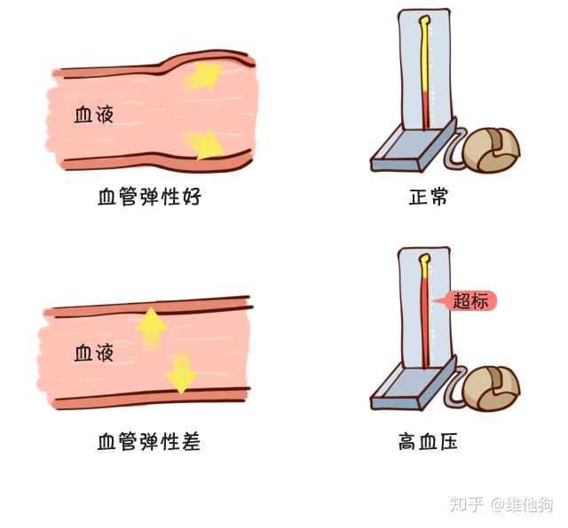 爸妈有高血压?请收下这波科普,关键时候能救命!