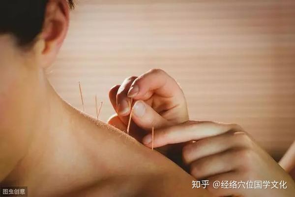 推拿针灸拔罐刺血调理肩周炎方法