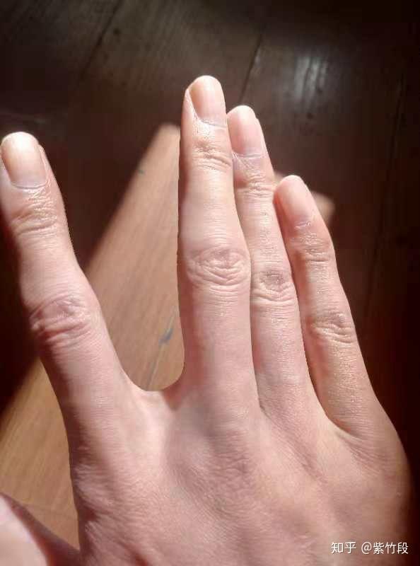 每个人的手指指缝大小都是一样的吗?有办法改变吗?