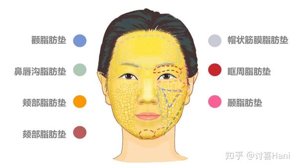 讨喜自己画了个面部脂肪垫区域的粗略图