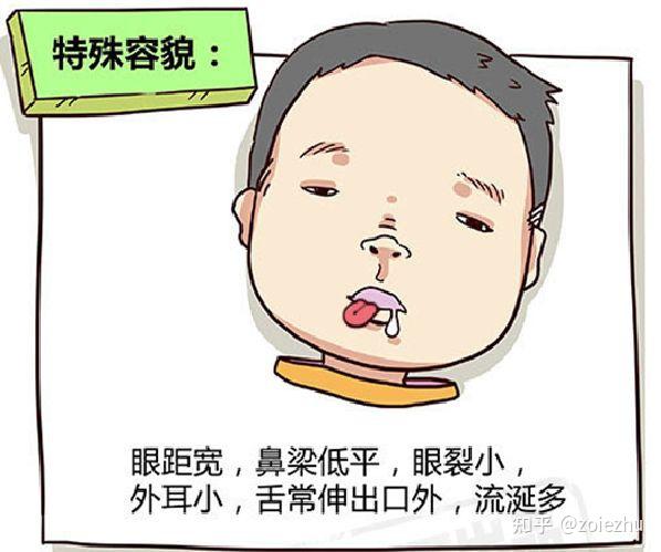 试管婴儿会得唐氏综合征吗?如何阻断遗传基因呢?