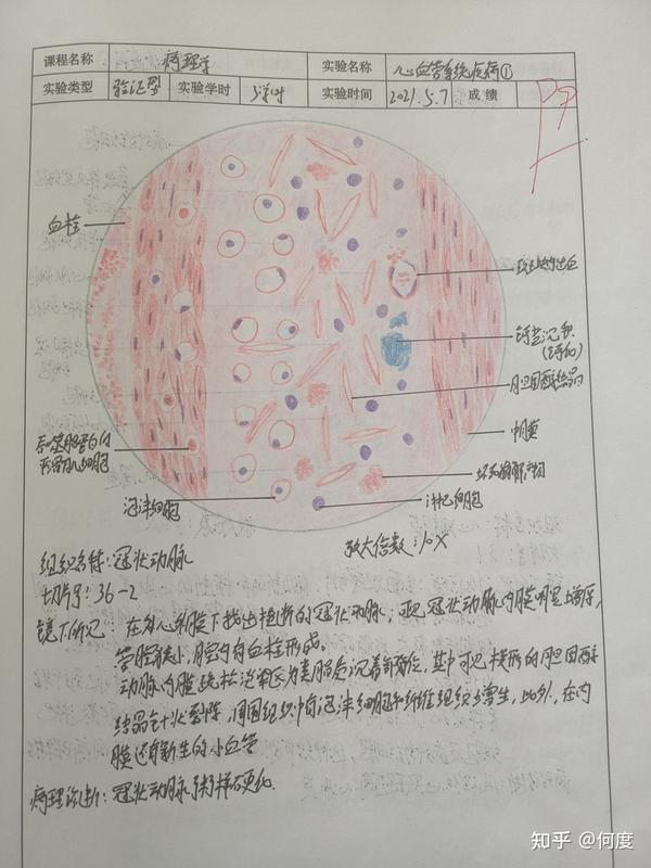 病理实验红蓝铅笔绘图