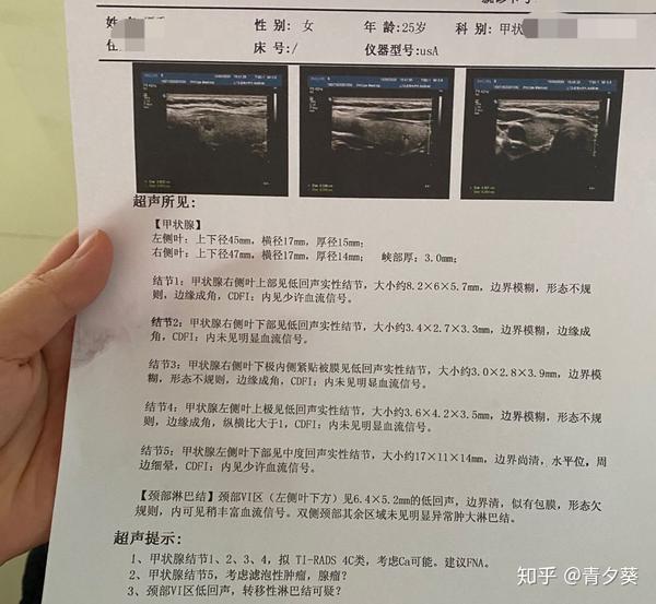 我原报告,说照得比较模糊,建议再照一次,找了医院比较有名的彩超医生