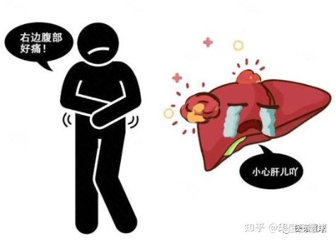早期肝癌的六个信号